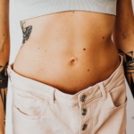 tummy tuck