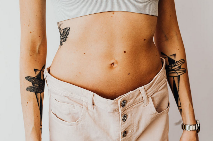 tummy tuck